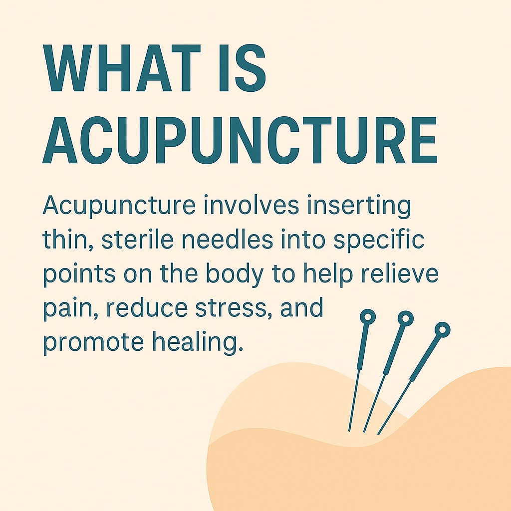 Educational graphic explaining what acupuncture is and how it relieves pain, stress, and promotes healing.