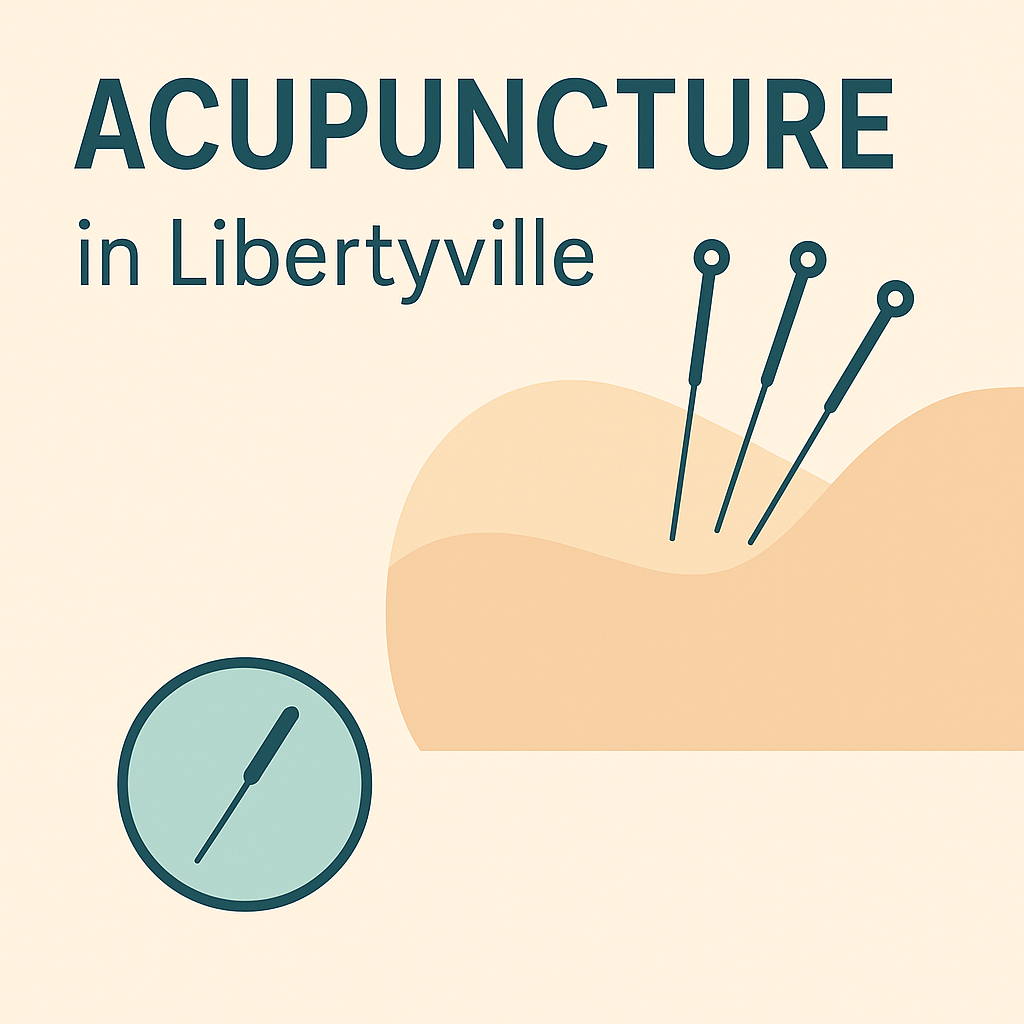 Illustration of acupuncture needles representing affordable acupuncture services in Libertyville, Illinois, offered by Dr. Steve Segal.